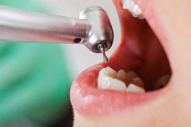 Best Emergency Treatment for Oral Infections in Pomona, NY